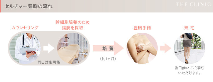 セルチャー豊胸（幹細胞培養豊胸）の手順