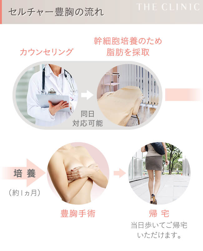 セルチャー豊胸（幹細胞培養豊胸）の手順