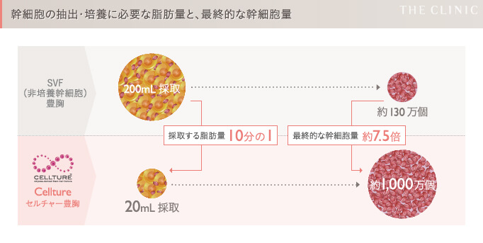 セルチャー豊胸とセリューション豊胸の幹細胞数の違い