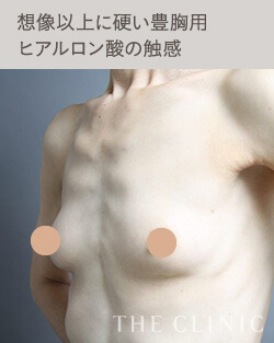 ヒアルロン酸豊胸のデメリット：触感が想像以上に硬い