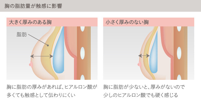 ヒアルロン酸豊胸は胸の脂肪量が触感に影響