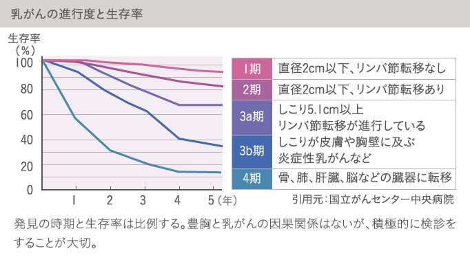 乳がんは早期発見が重要