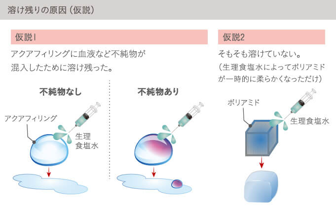 アクアフィリングが溶けない原因