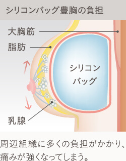 大きなシリコンバッグを追加した時のバスト