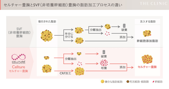セルチャーとセリューションの加工プロセスの違い