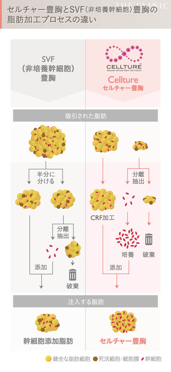 セルチャーとセリューションの加工プロセスの違い